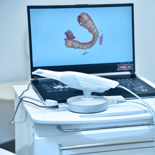 scanner intraorale 3d