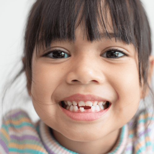 traumi denti da latte